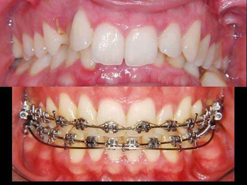 Orthodontic Treatments - Main View