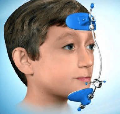 Myofunctional Treatment for Proper Oral Development