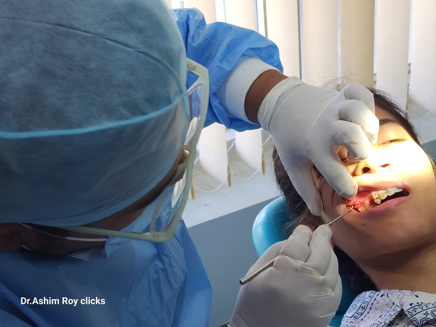 Restore Your Smile for Life: An In-Depth Guide to Dental Implants Treatment in Silchar